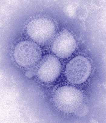 Image: The H1N1 influenza virus (Photo courtesy of US Centers for Disease control).